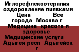 Иглорефлексотерапия, оздоровление пиявками › Цена ­ 3 000 - Все города, Москва г. Медицина, красота и здоровье » Медицинские услуги   . Адыгея респ.,Адыгейск г.